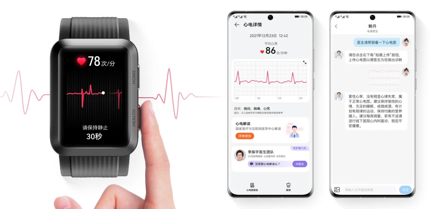 Huawei Watch D ECG report